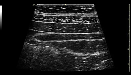 venue-point-of-nerve-block-card2-ci-en