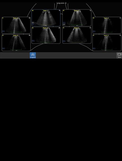 venue-point-of-review-lung-card2-3-ci-en