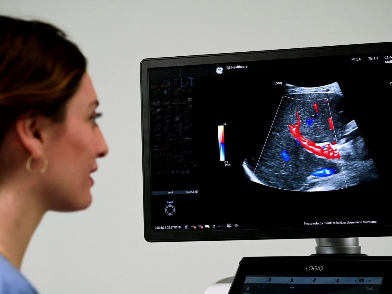 <p>AI for general imaging</p>
