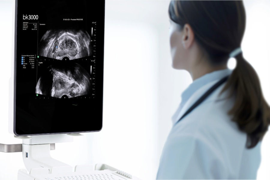 <p>AI for urology</p>
