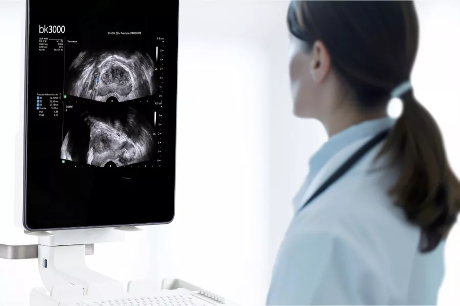 <p>AI for urology</p>

