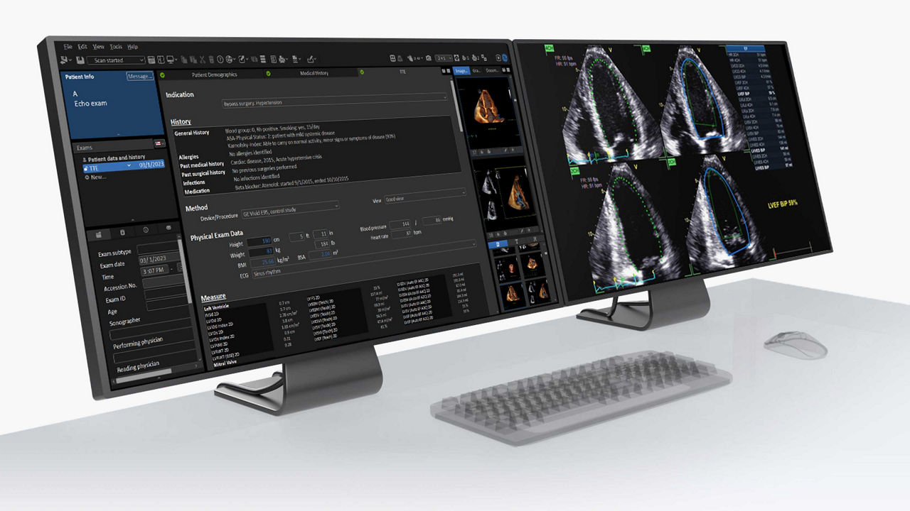 ECG cables and leadwires.
