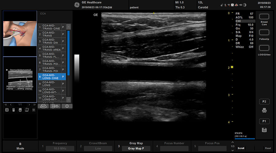 versana-active-scan-coach