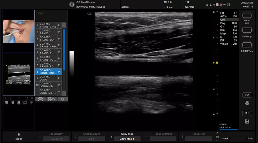 versana-active-scan-coach