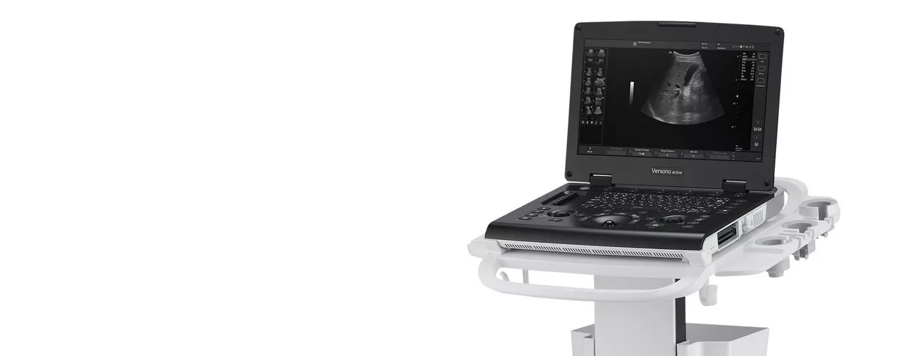 versana-active-ultrasound-product-image-ci-en