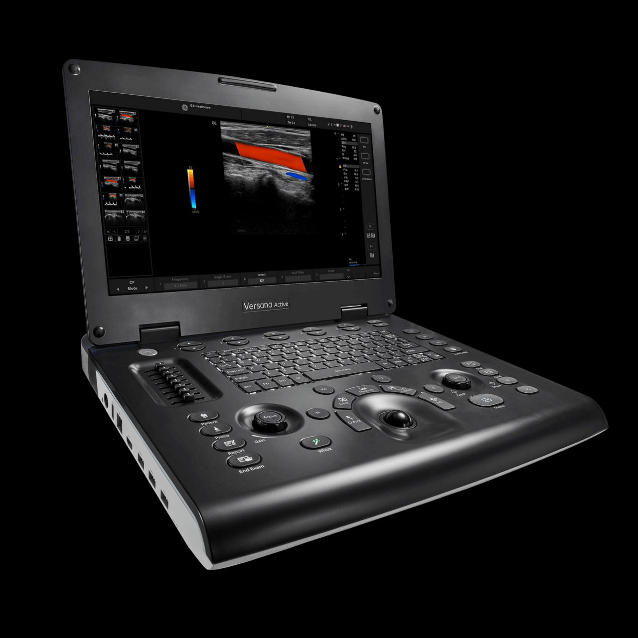 versana-active-ultrasound-product-tile-en