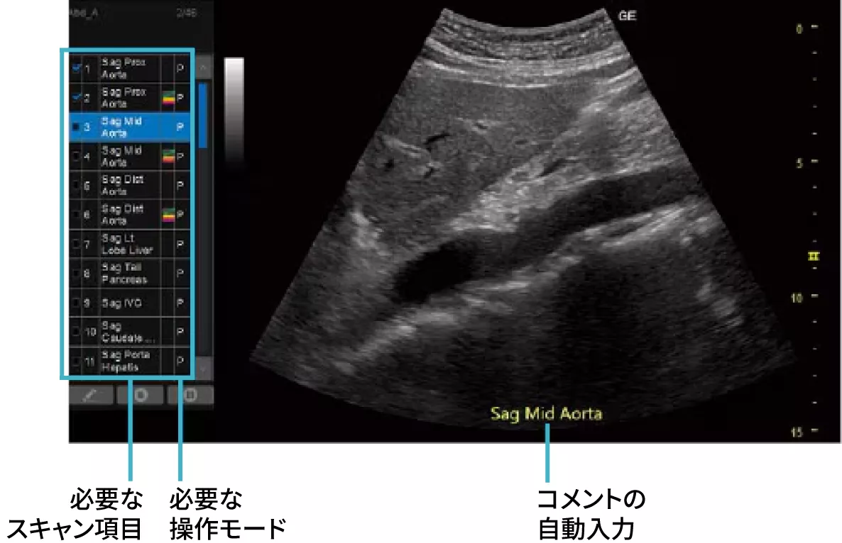 Versana_02_ScanAssistant