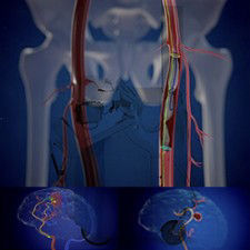 vessel-assist-mobile