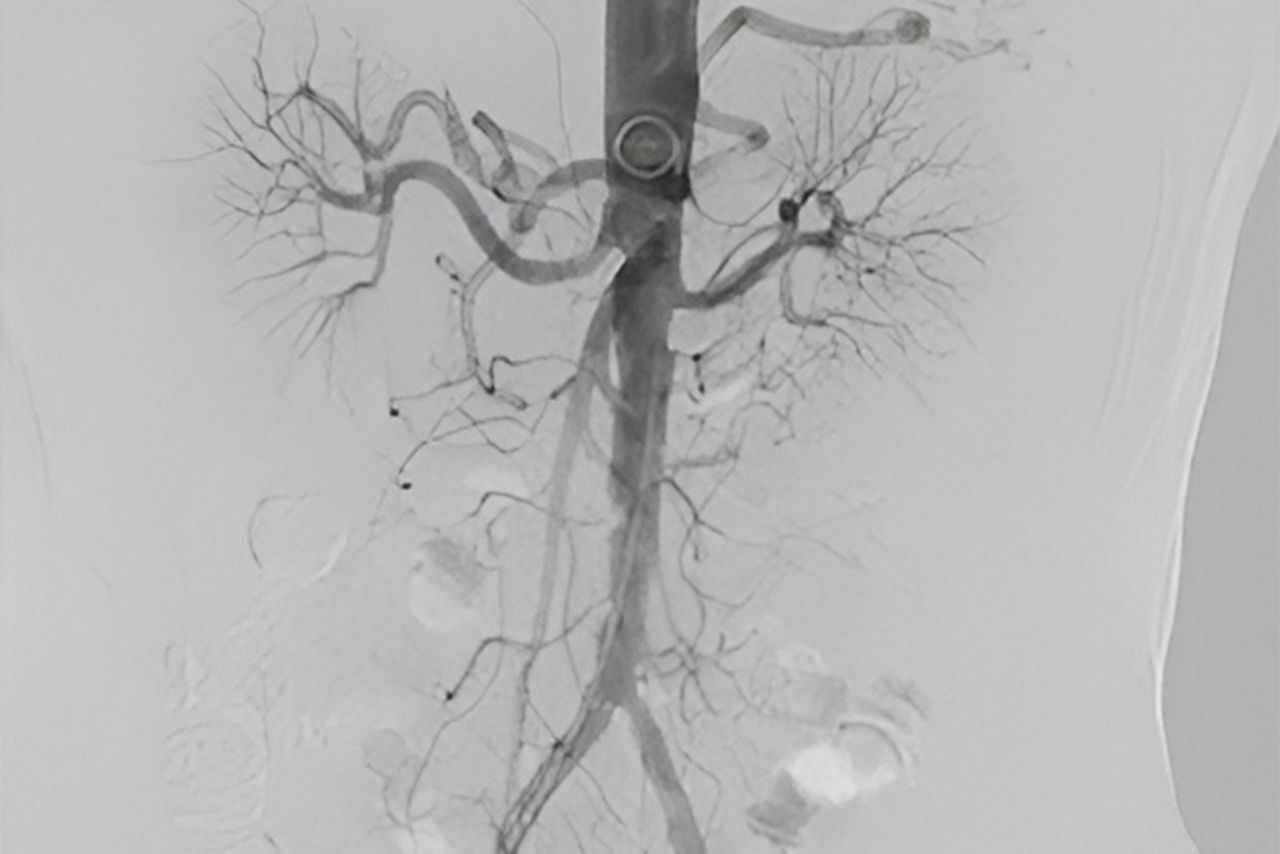 vessel-assist-technician-operating-ci-en_2