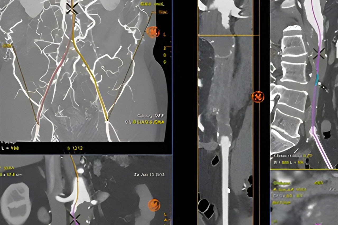 vessel-assist-technician-operating-ci-en_3