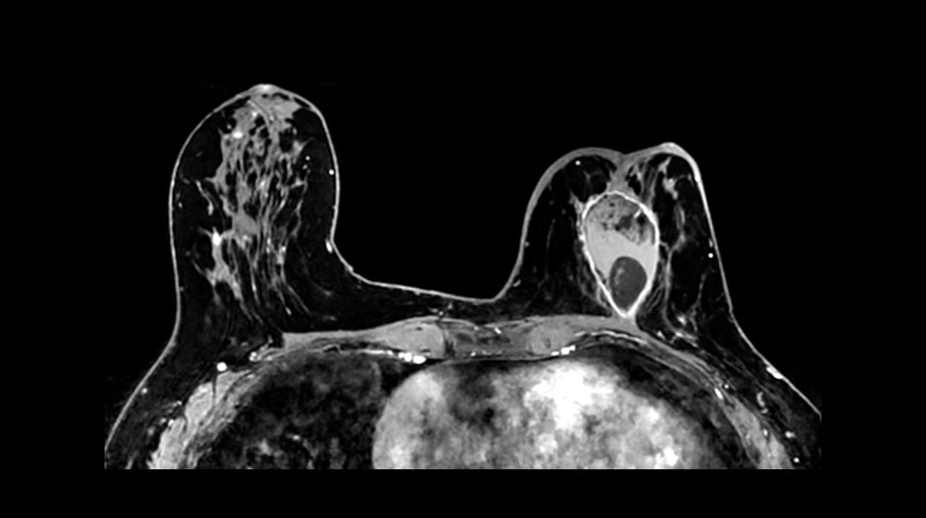 Vibrant-and-VibrantFlex1040-x-585