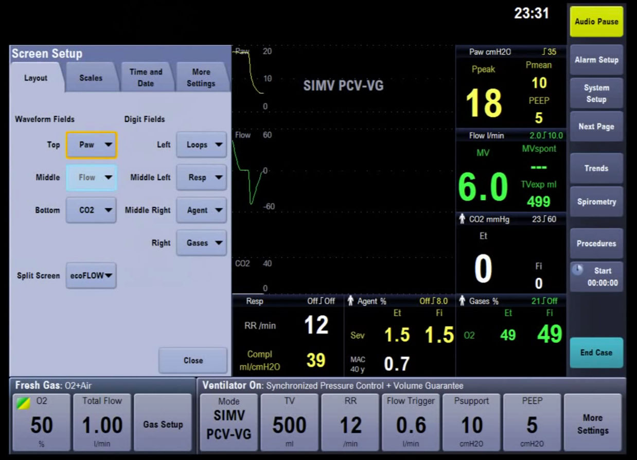video-screensetup
