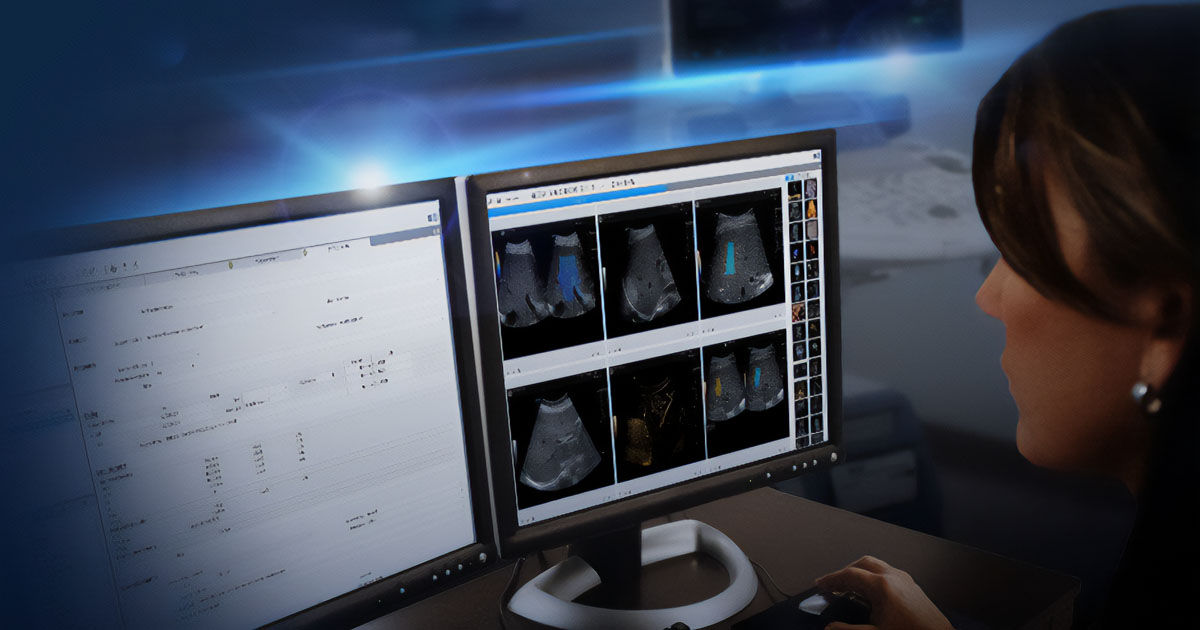 viewpoint-6-ultrasound-og-image-doctor-watching-screen-og-ci-en