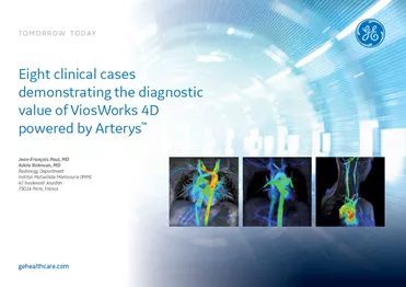 ViosWorks_Clinical_Cases_Brochure_200x155_1