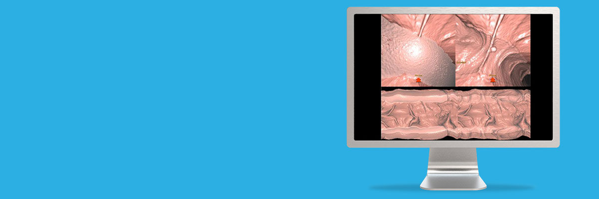 aw-advantage_CTC_Pro_EC_3D_spotlight