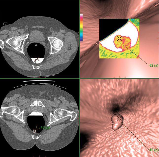 visualizationapplicationsadvantagectcpro3decawadvantagectcproec3doverviewjpg