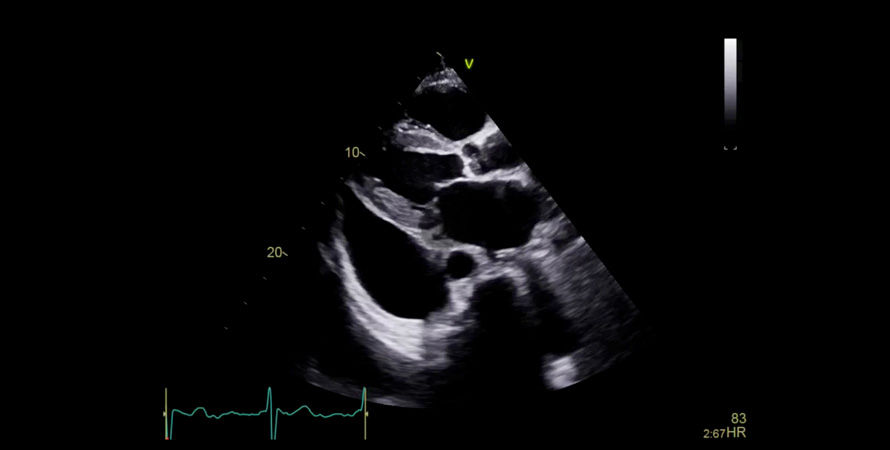True Confocal Imaging