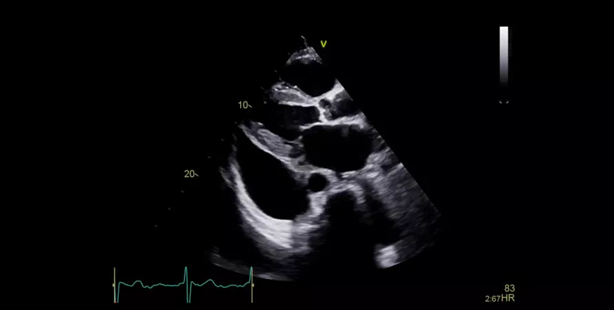 Vivid-E90-true-confocal-imaging