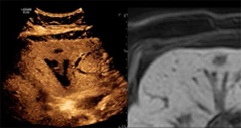 vivid-e95-cardiac-ultrasound-logiq-st-en