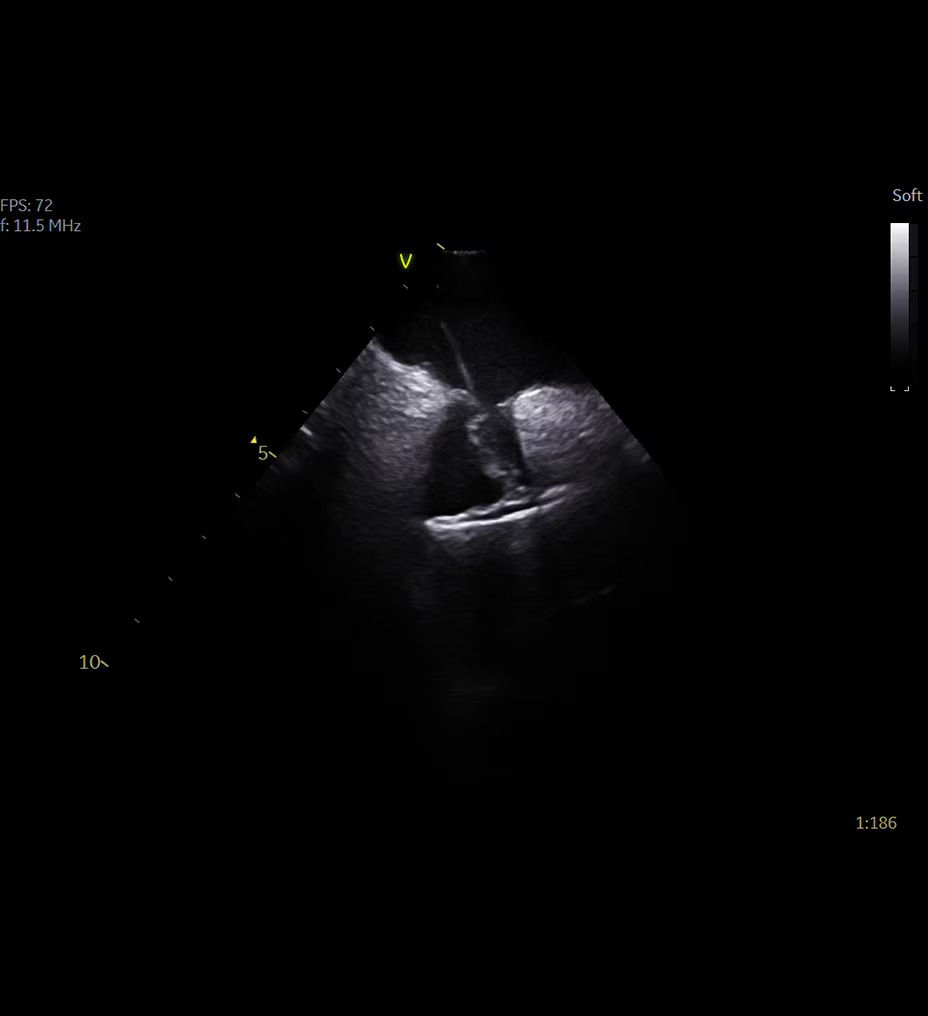 vivid-iq-high-versatility-ci-en