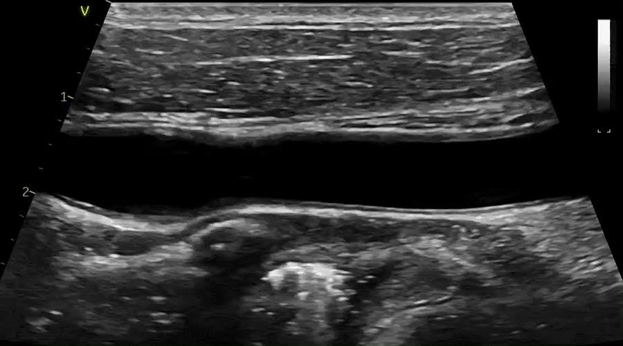 Vivid-iq-img-007-Vascular-Imaging