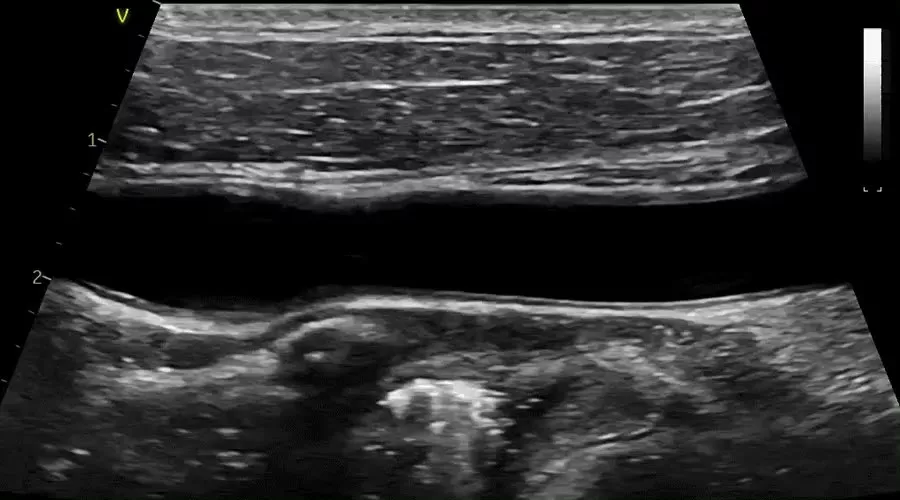 Vivid-iq-img-007-Vascular-Imaging