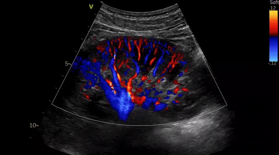 Vivid-iq-img-008-abdominal_imaging