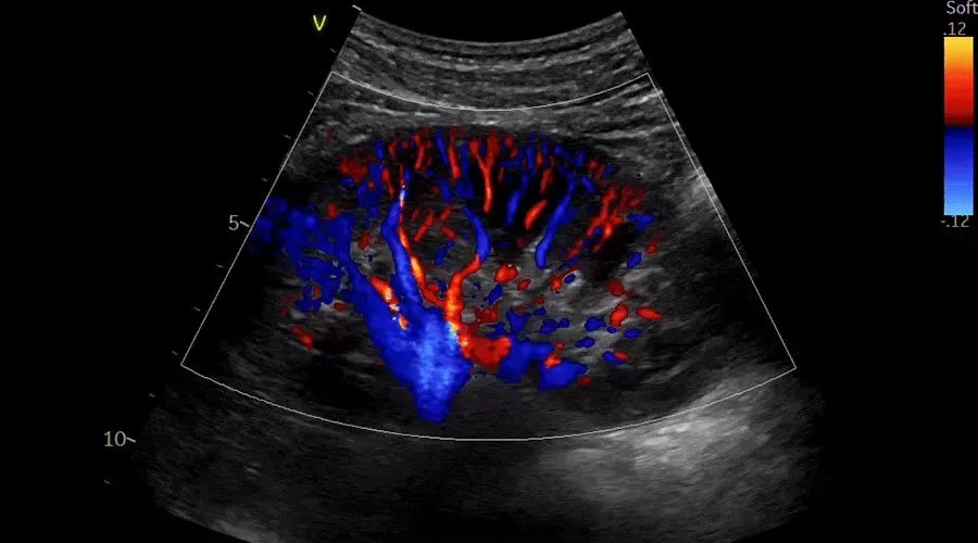 Vivid-iq-img-008-abdominal_imaging