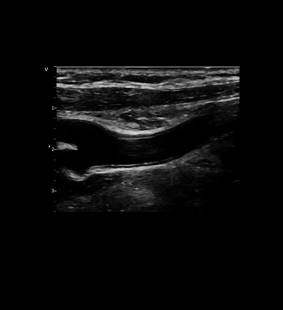 vivid-iq-superb-image-quality-ci-en