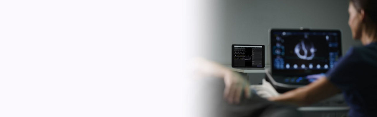 vivid-iq-viewpoint-echopilot-dynamic-ci-en