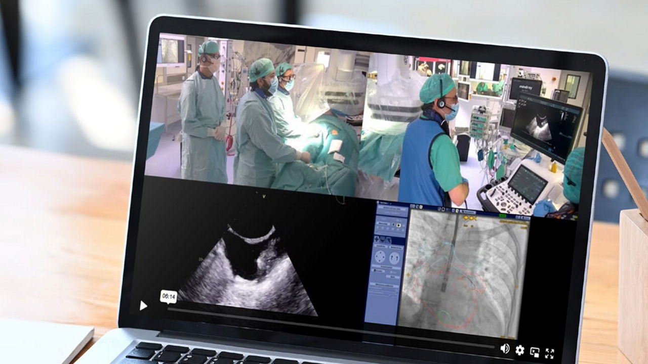 <p>Clinical case: Sealing the risk: a case of left atrial appendage closure</p>
