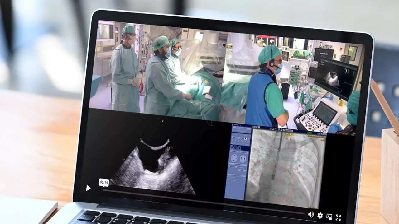 <p>Clinical case: Sealing the risk: a case of left atrial appendage closure</p>
