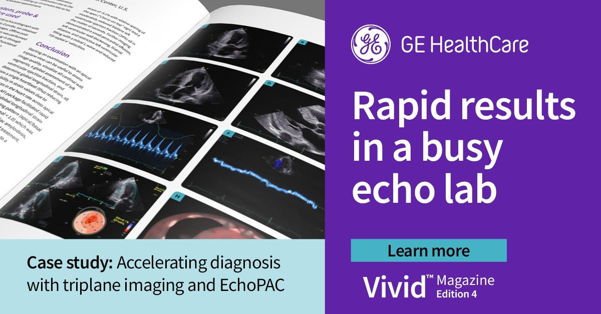 <p>Rapid results in a busy echo lab</p>
