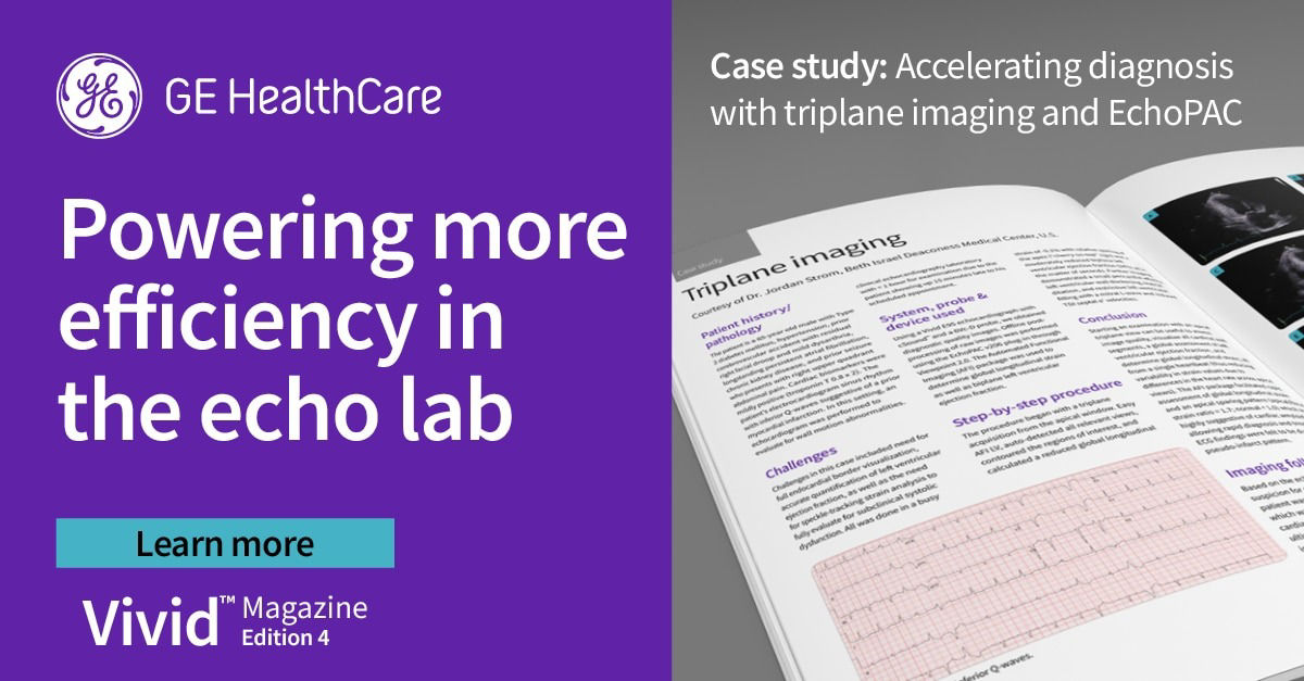 <p>Powering more efficiency in the echo lab</p>
