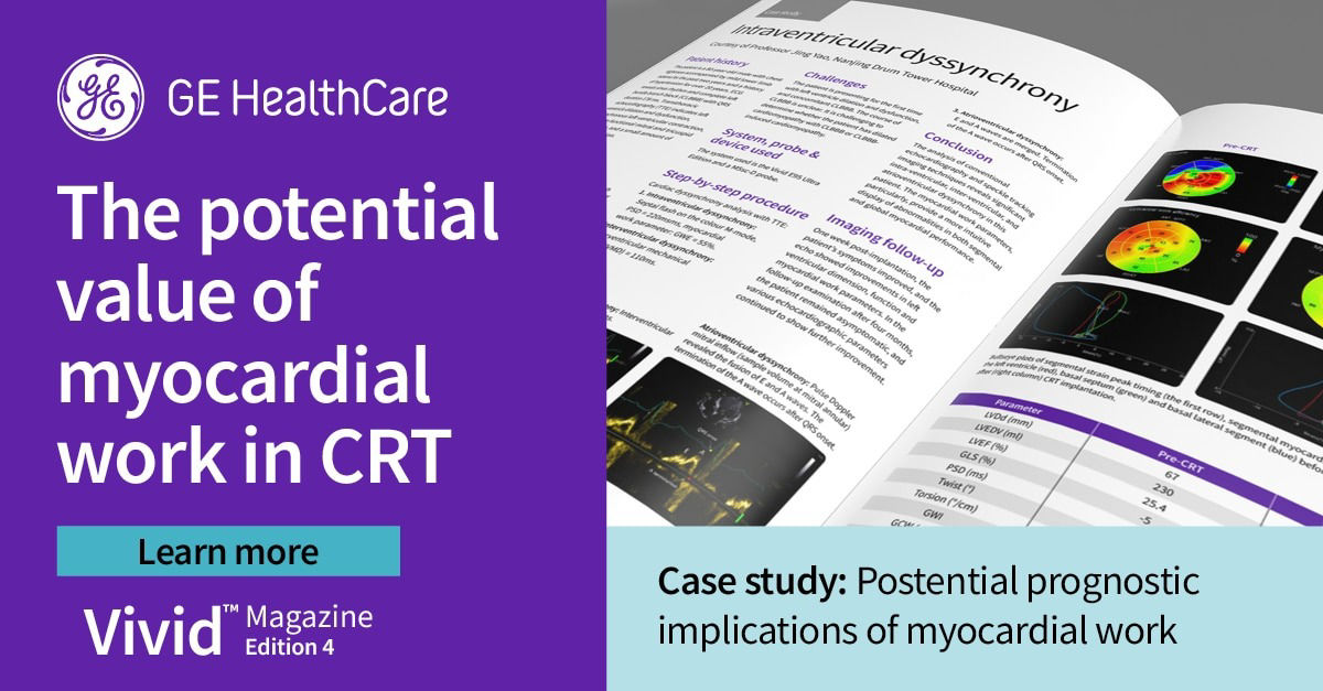<p>Case Study: Possible prognostic implications of myocardial work</p>
