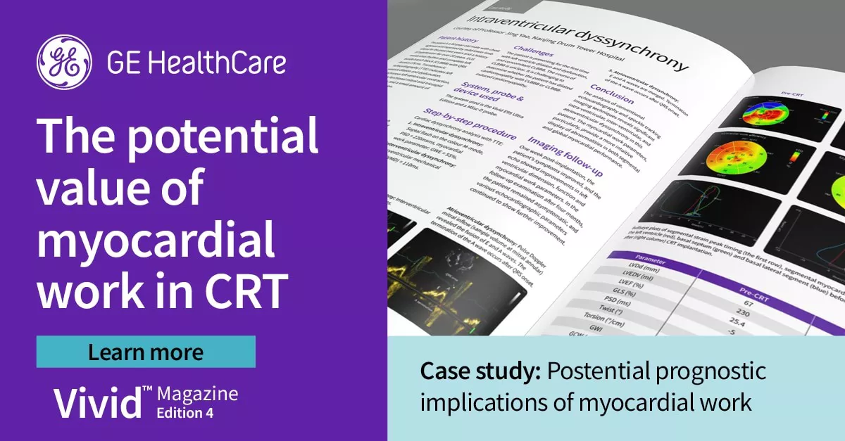 <p>Case Study: Possible prognostic implications of myocardial work</p>
