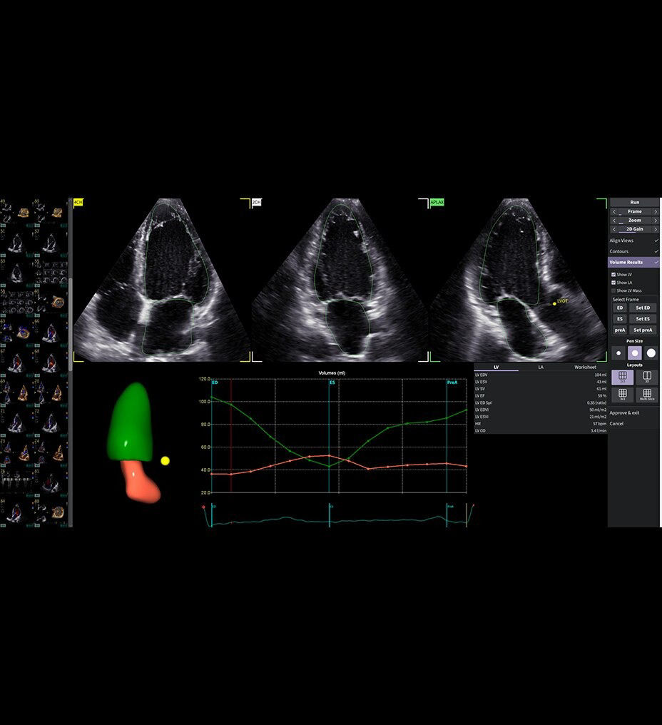 vivid-pioneer-extraordinary performance-ci-en
