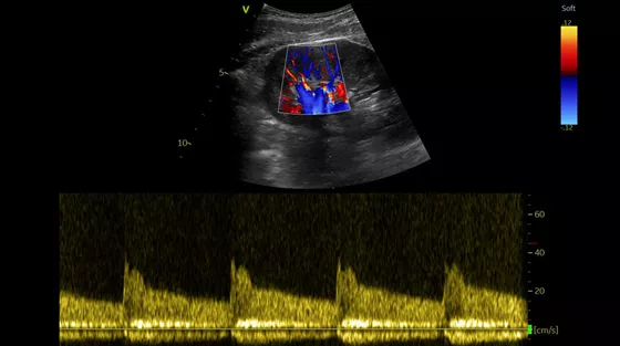 Vivid-S60N-img-006-abdomen-thumbnail