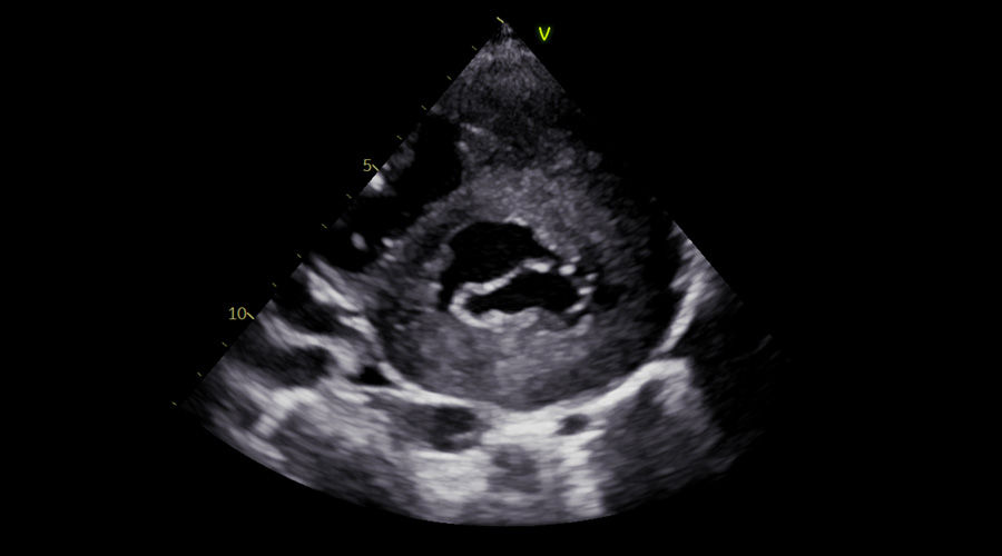 Vivid-S70N-img-006-pediatric