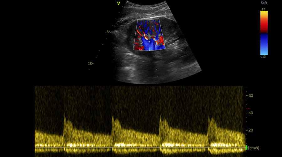 Vivid-S70N-img-009-abdomen