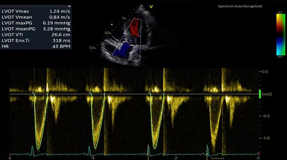 Auto Measure Spectrum Recognition