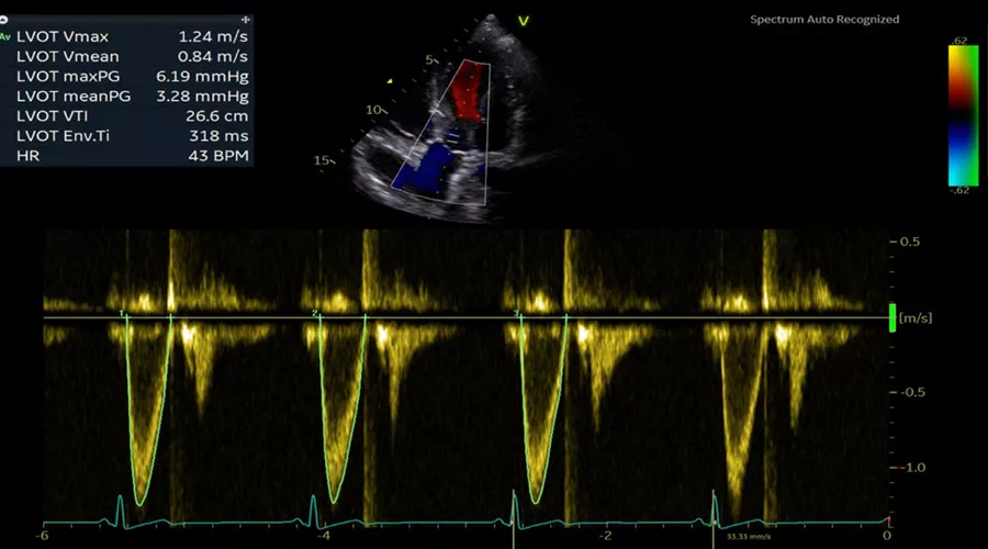 Vivid-T9-img-003