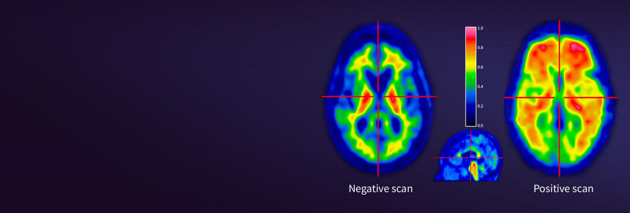 vizamyl-hero-desktop