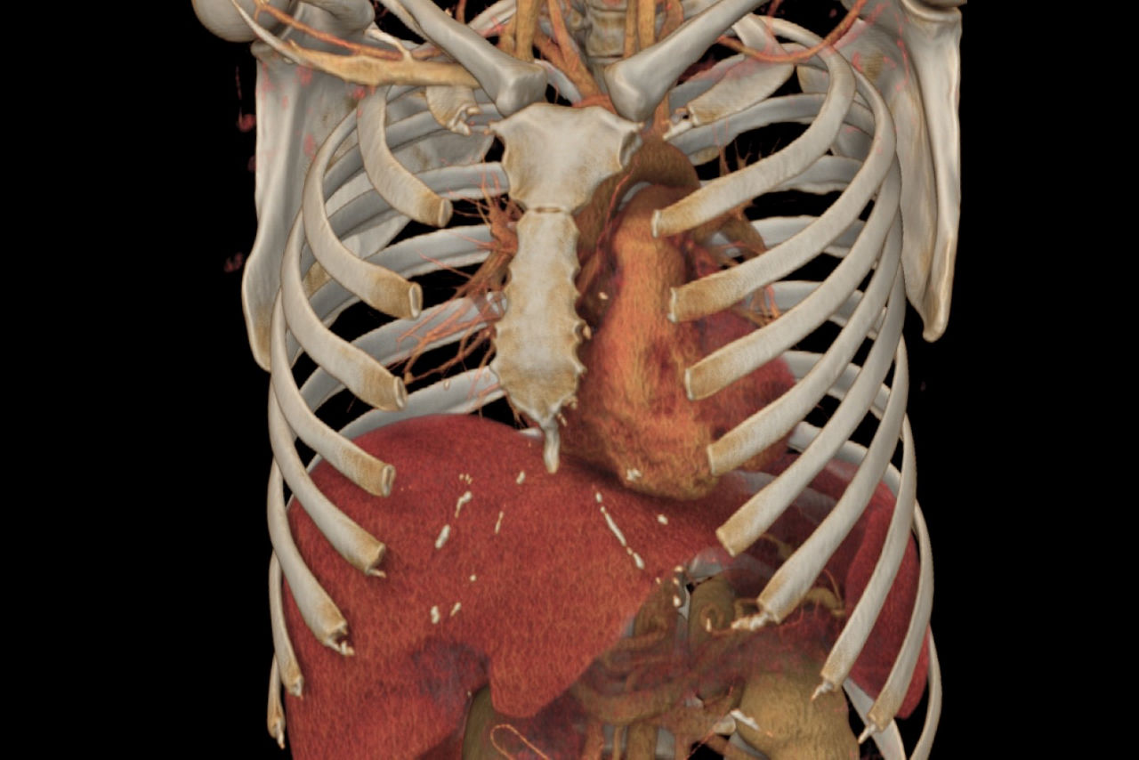 volume-viewer-herosticky-ci-en