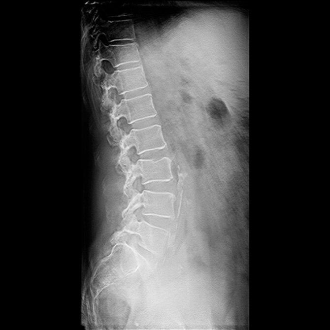 volumerad-product-tile-en