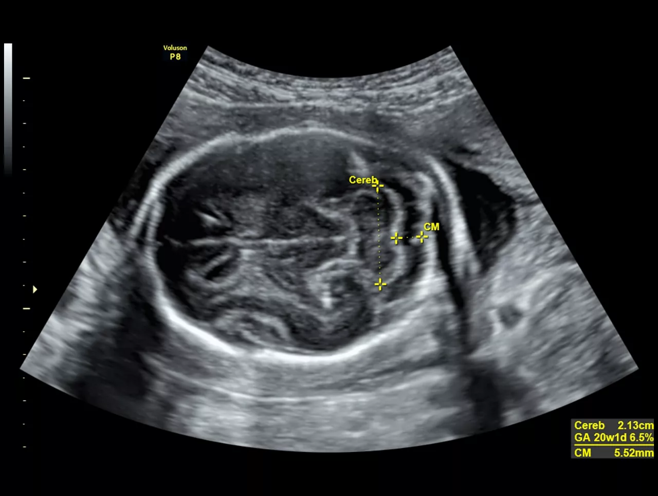 voluson-P8-technology-sonobio-ci-en