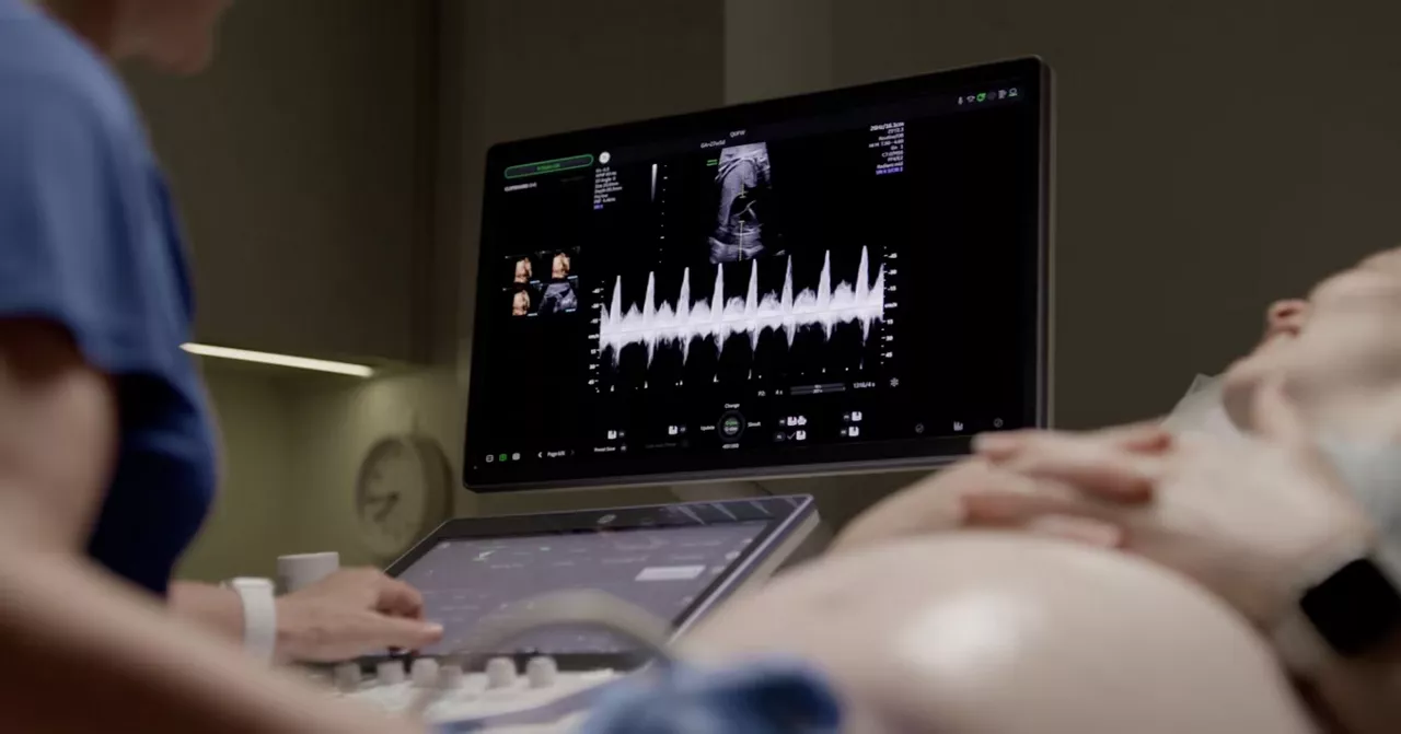 voluson-antenatal-care-video-te-en