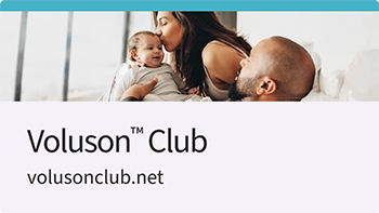 voluson-club-350
