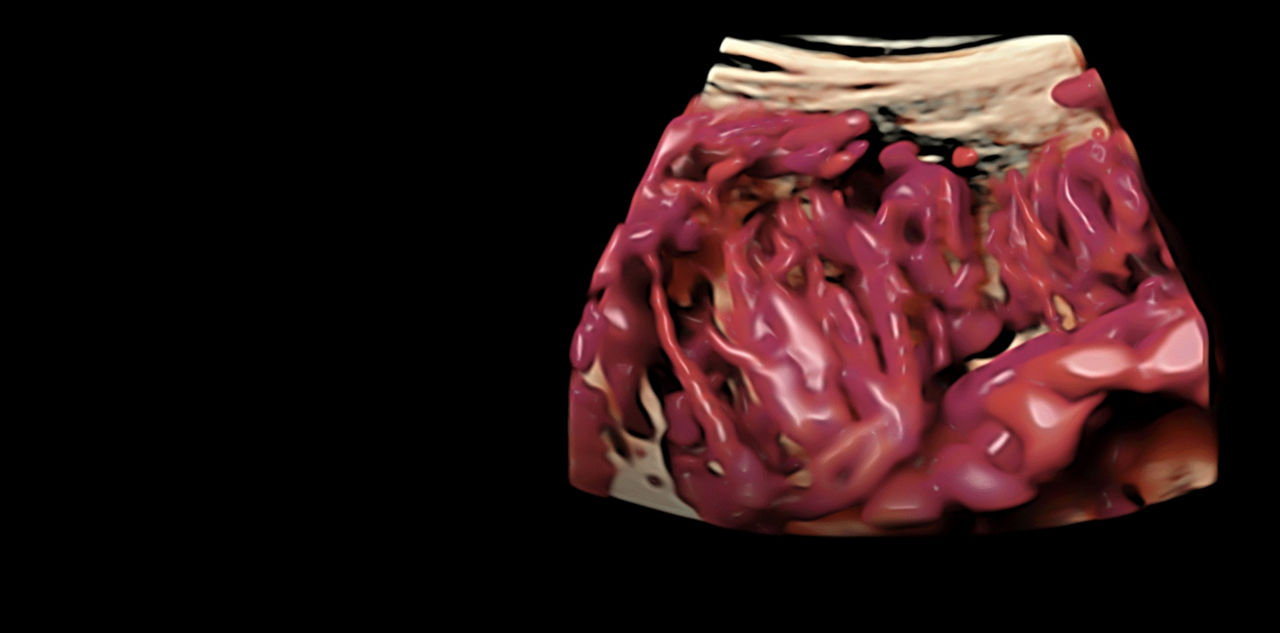 voluson-expert-18-color-imaging-ci-en