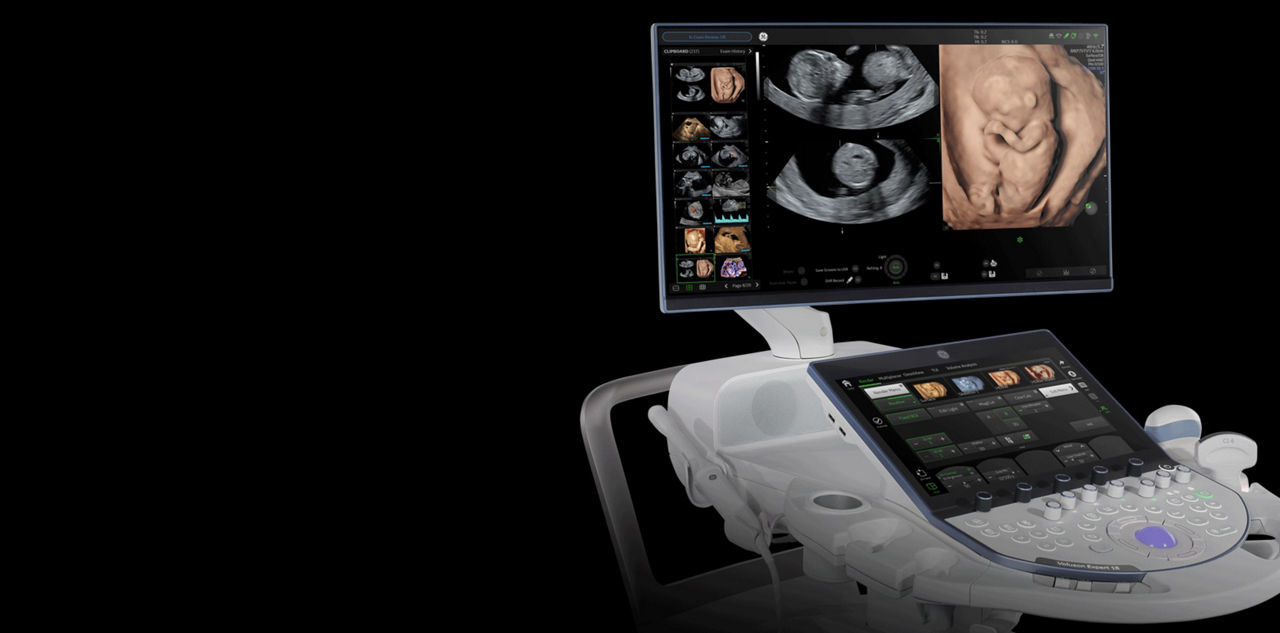 voluson-expert-18-contemporary-design-st-en